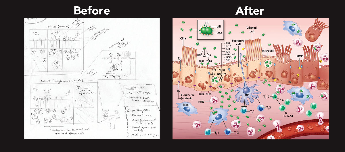 A rough pencil sketch next to one of Katie Stanley's final medical illustrations with full color and detail